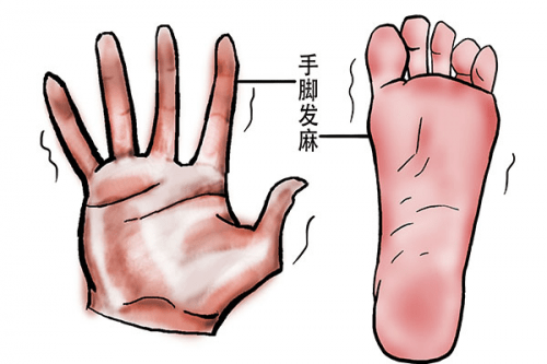 手腳經(jīng)常發(fā)麻是什么原因?手腳發(fā)麻可能患有哪些疾?。? /></span></p><p style=